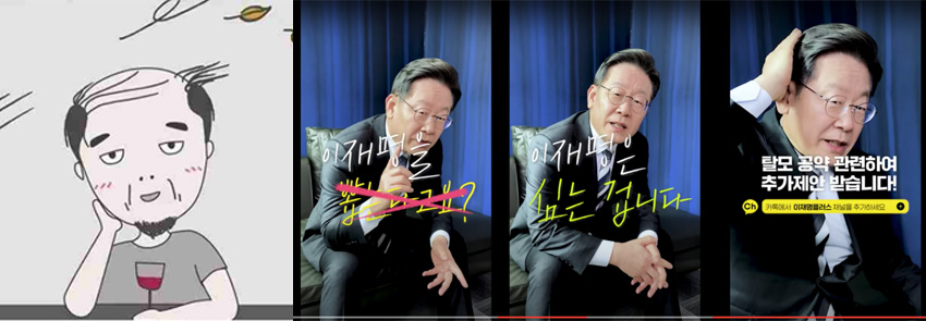 Korean politician accepts hair transplant as useful