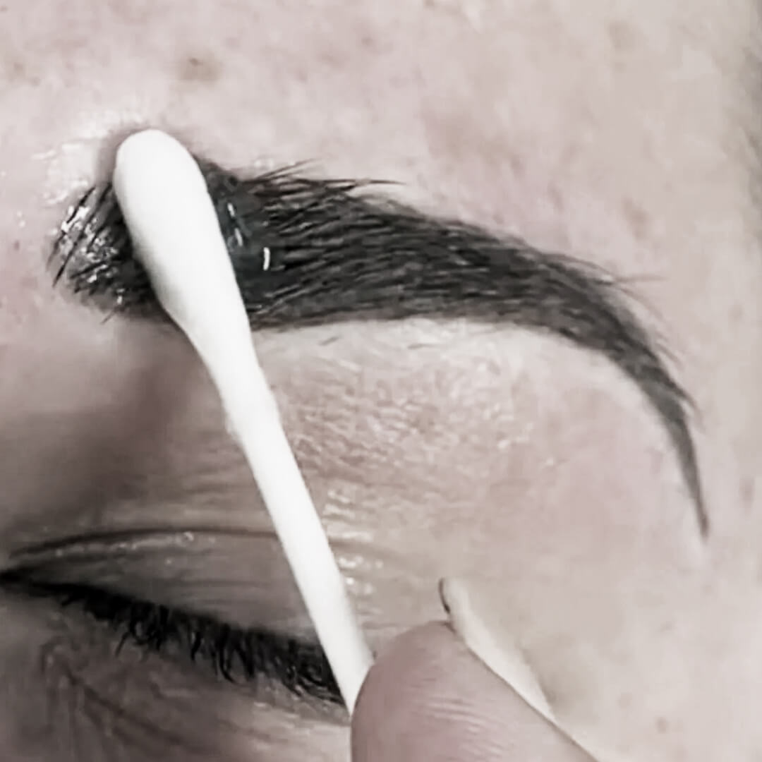 Ointment application