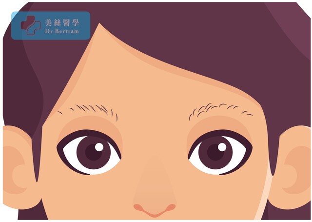 眉毛稀疏