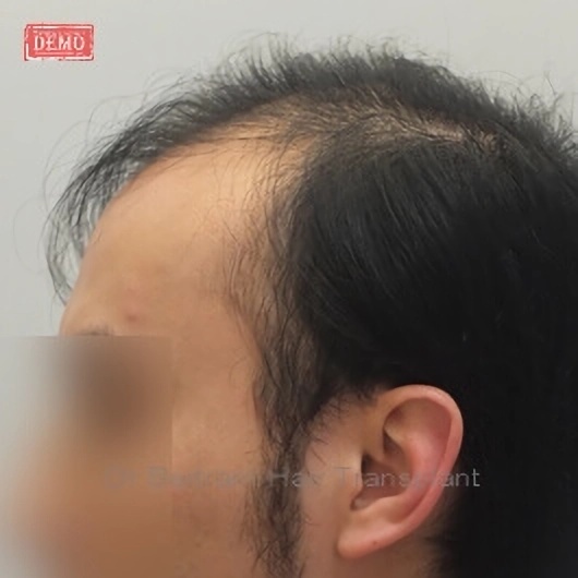 術前：後方角度