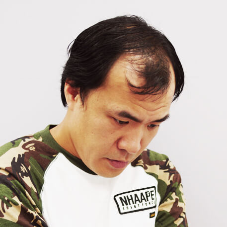 術前